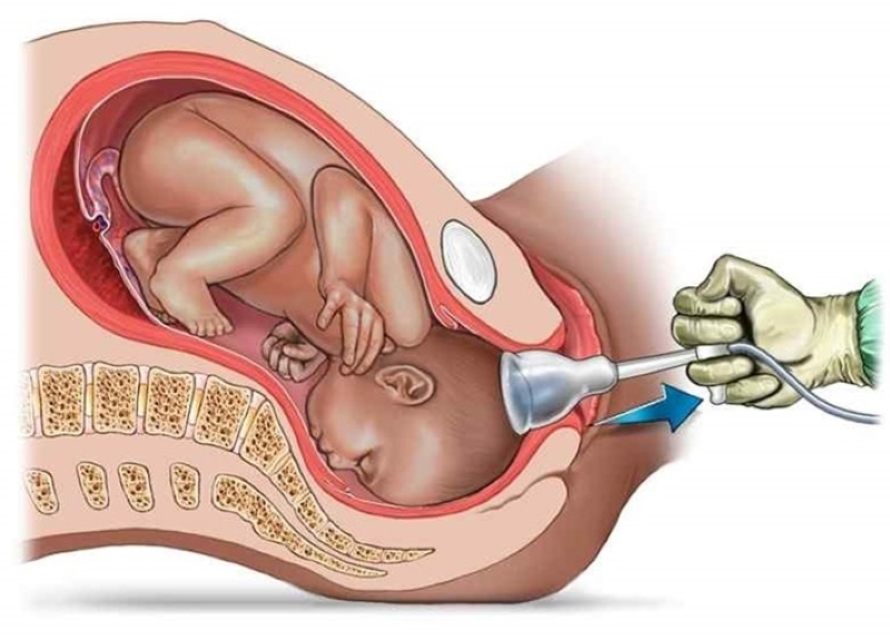 cẩm nang mang thai và sinh con chi tiết