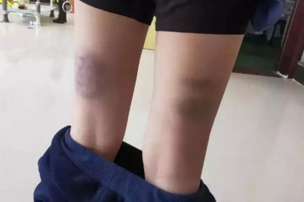 Hình ảnh minh họa hành vi giáo viên đánh học sinh và hậu quả pháp lý liên quan