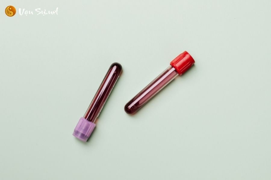Sổ mơ và các con số liên quan đến giấc mơ thấy máu