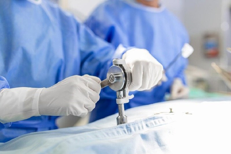 Bác sĩ phẫu thuật thảo luận về quy trình thay đĩa đệm nhân tạo