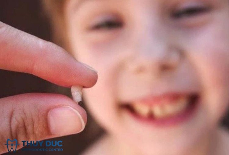 Biểu tượng điềm báo may mắn hoặc xui xẻo khi mơ thấy răng rụng không chảy máu