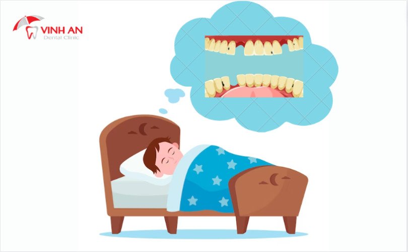 Các nguyên nhân tâm lý khiến bạn mơ thấy răng bị gãy