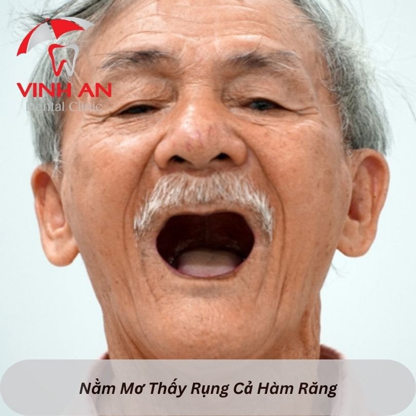 Con số liên quan khi nằm mơ thấy rụng cả hàm răng