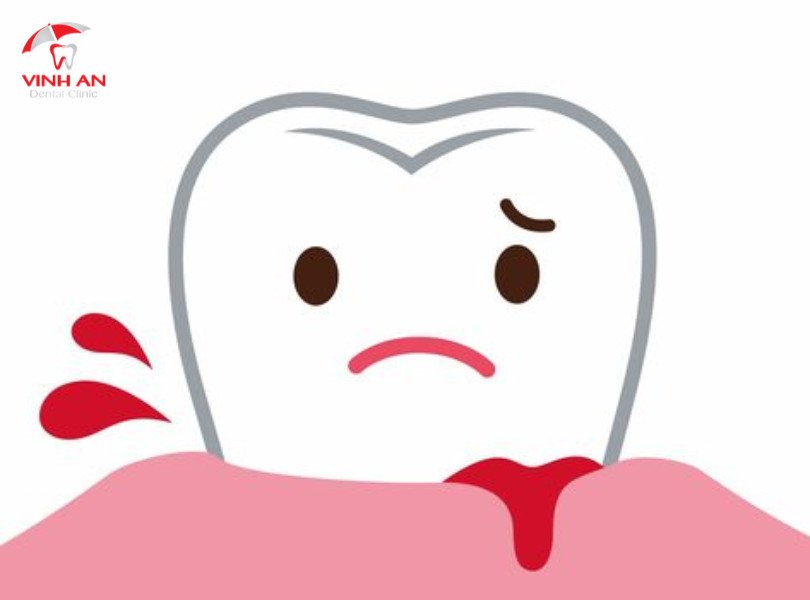Giấc mơ bẻ răng chảy máu, điềm báo về những khó khăn sắp tới
