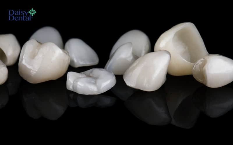Giấc mơ thấy răng mới bị rụng hoặc rơi rớt là điềm báo về những mất mát tài chính hoặc mối quan hệ