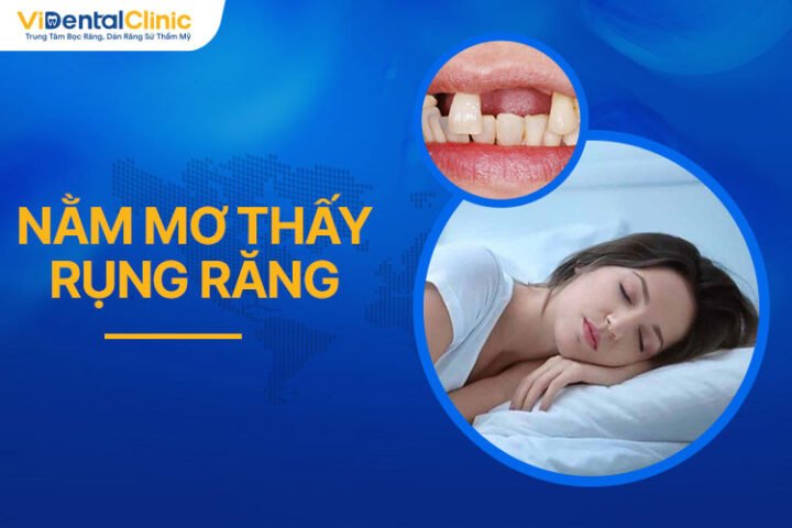 Giấc mơ thấy rụng răng phản ánh nỗi sợ hãi về sự mất mát hoặc bất lực