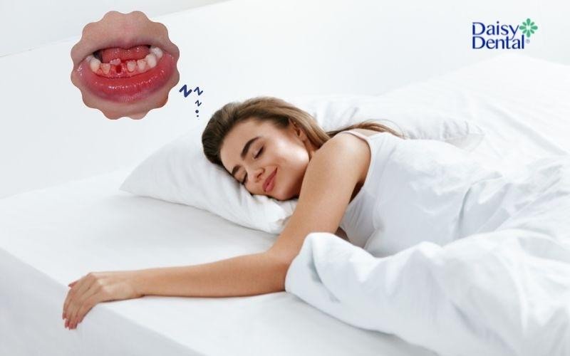 Giải mã giấc mơ rụng 3 răng chảy máu: biểu tượng của sự lo âu