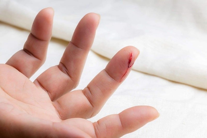 Giải mã giấc mơ thấy chảy máu ở tay cần thay đổi bản thân