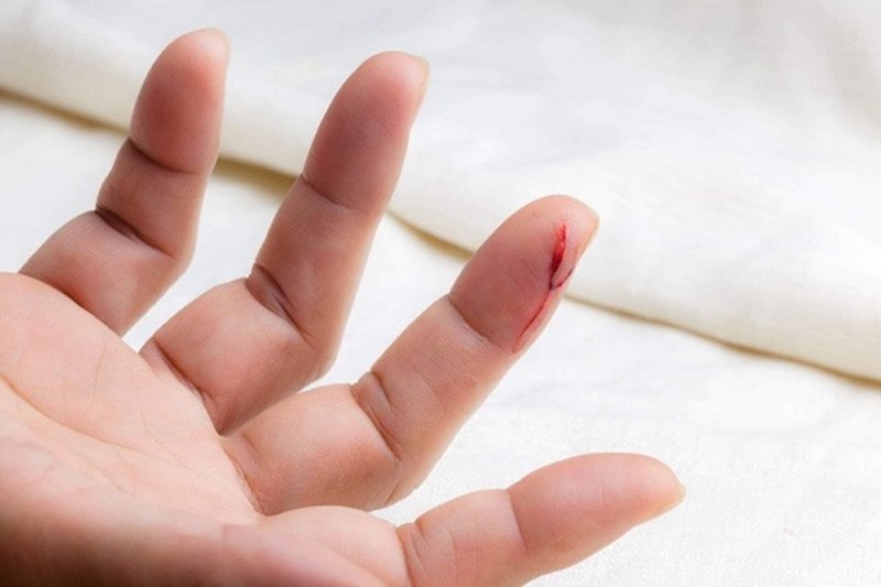 Giải mã ý nghĩa giấc mơ thấy đứt ngón tay