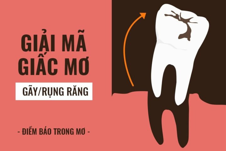 Giải mã ý nghĩa khi ngủ mơ thấy gãy răng chảy máu