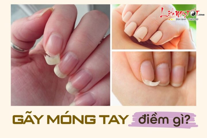 Hình ảnh minh họa điềm báo nằm mơ thấy gãy móng tay