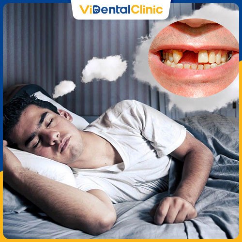 Hình ảnh một người đang lo lắng về việc răng lung lay rồi rụng