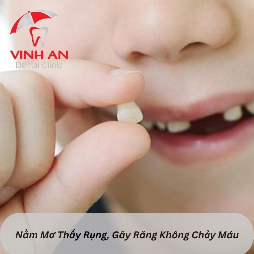 Mơ thấy lặp lại số may mắn