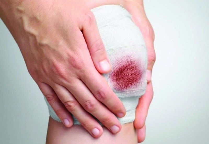 Nằm mơ thấy chảy máu ở chân là điềm báo may mắn hay rủi ro