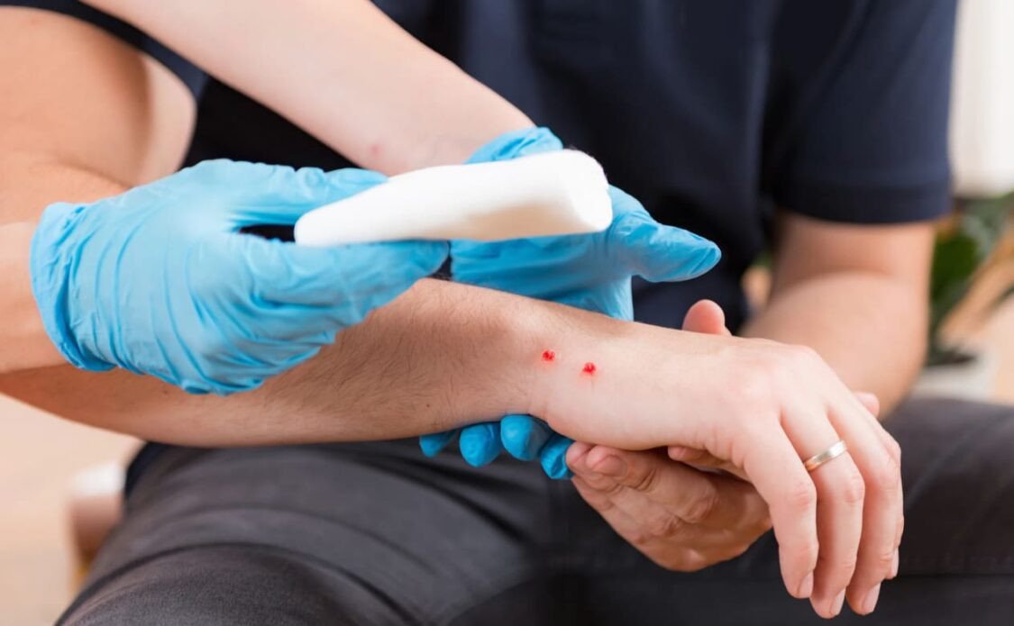 Ngủ mơ thấy bị rắn cắn chảy máu có ý nghĩa gì