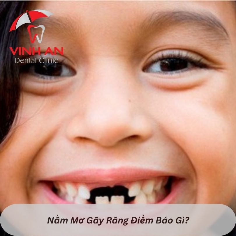 Người phụ nữ suy tư về điềm báo giấc mơ rụng răng