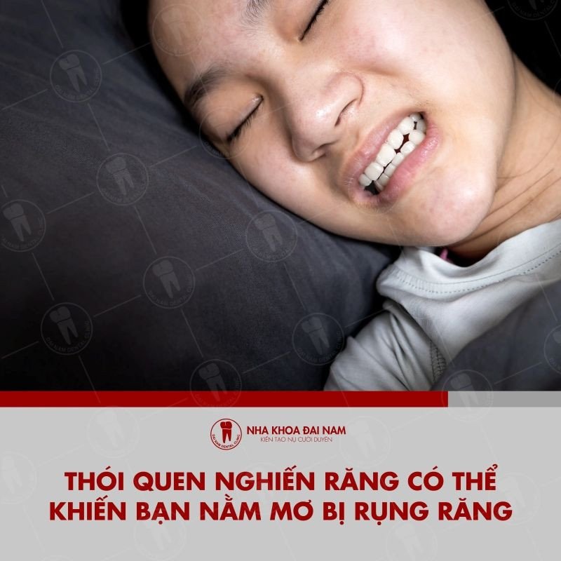 Tác động của thói quen nghiến răng ban đêm đến giấc mơ rụng răng