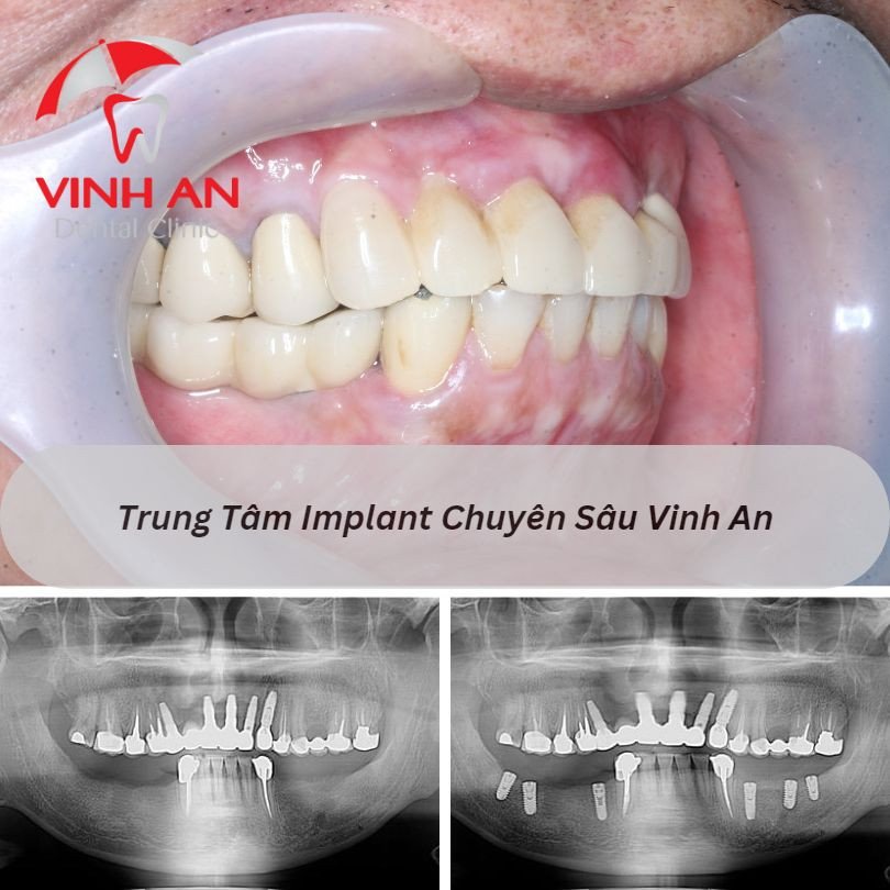 Thông tin hữu ích về giải mã giấc mơ