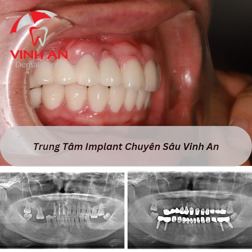 Tìm kiếm ý nghĩa ẩn chứa trong giấc mơ