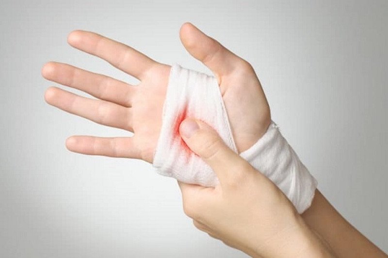Ý nghĩa giấc mơ thấy đứt tay không chảy máu