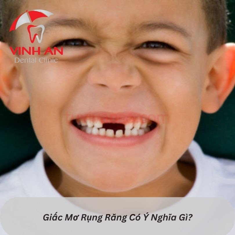 Ý nghĩa tổng quát của giấc mơ rụng răng